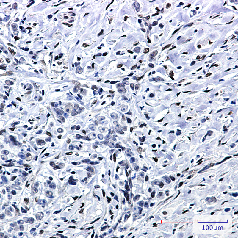 FTO Rabbit mAb