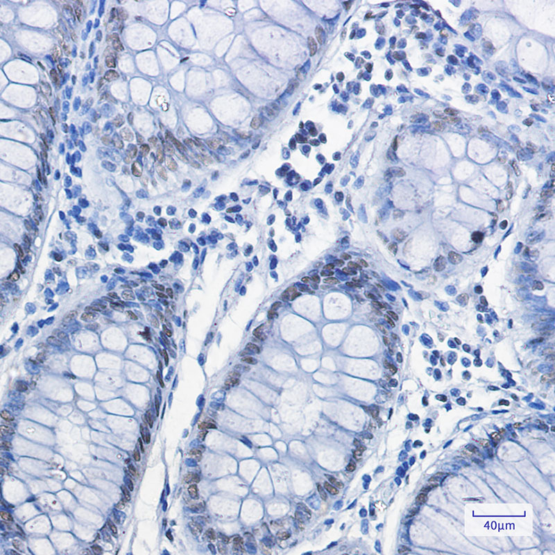 FUBP1 Rabbit mAb
