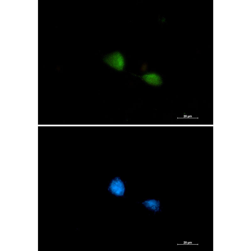 FUBP1 Rabbit mAb