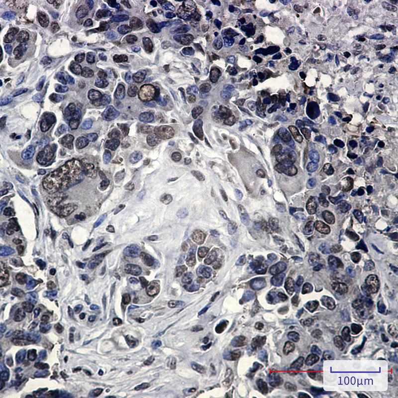 FUBP1 Rabbit mAb