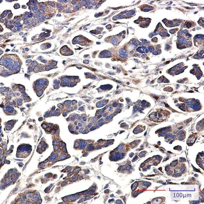 GNA13 Rabbit mAb