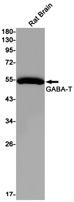 ABAT Rabbit mAb
