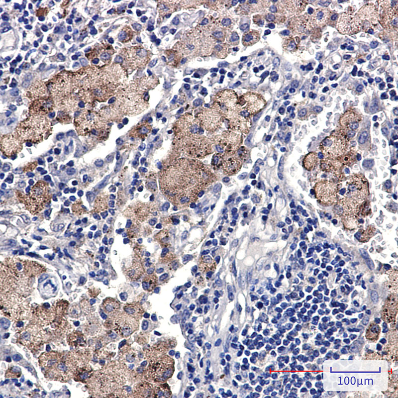 SMN Rabbit mAb