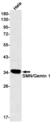 SMN Rabbit mAb