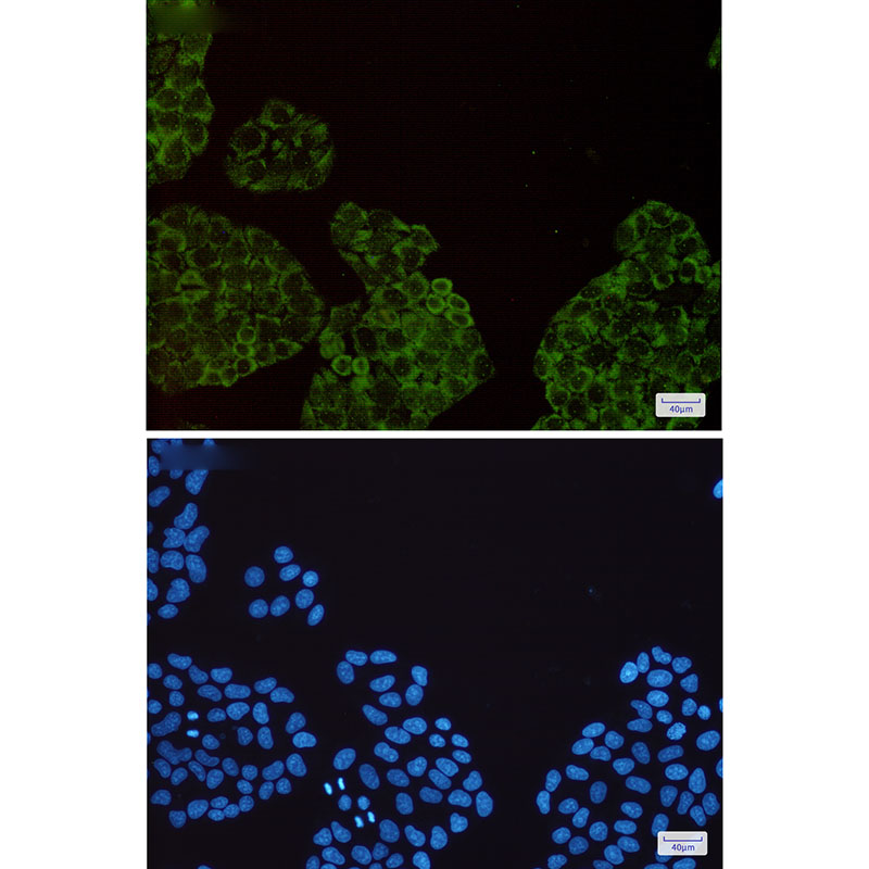 SMN Rabbit mAb