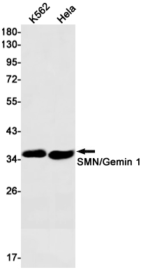 SMN Rabbit mAb