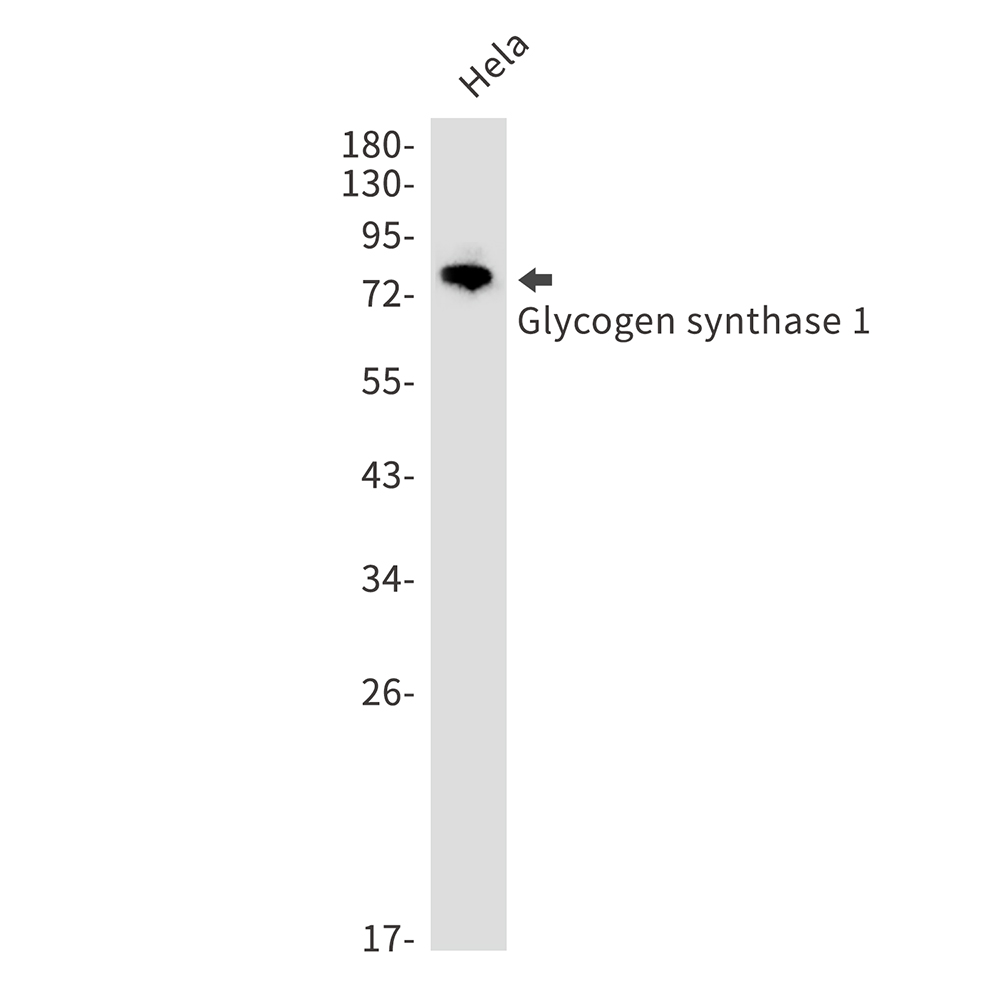 Glycogen Synthase 1 Rabbit mAb