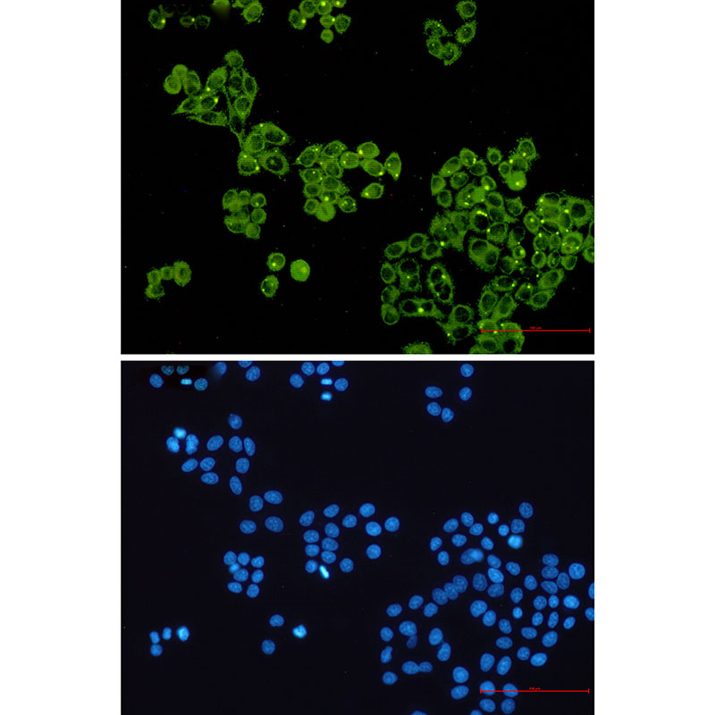 Glycogen Synthase 1 Rabbit mAb