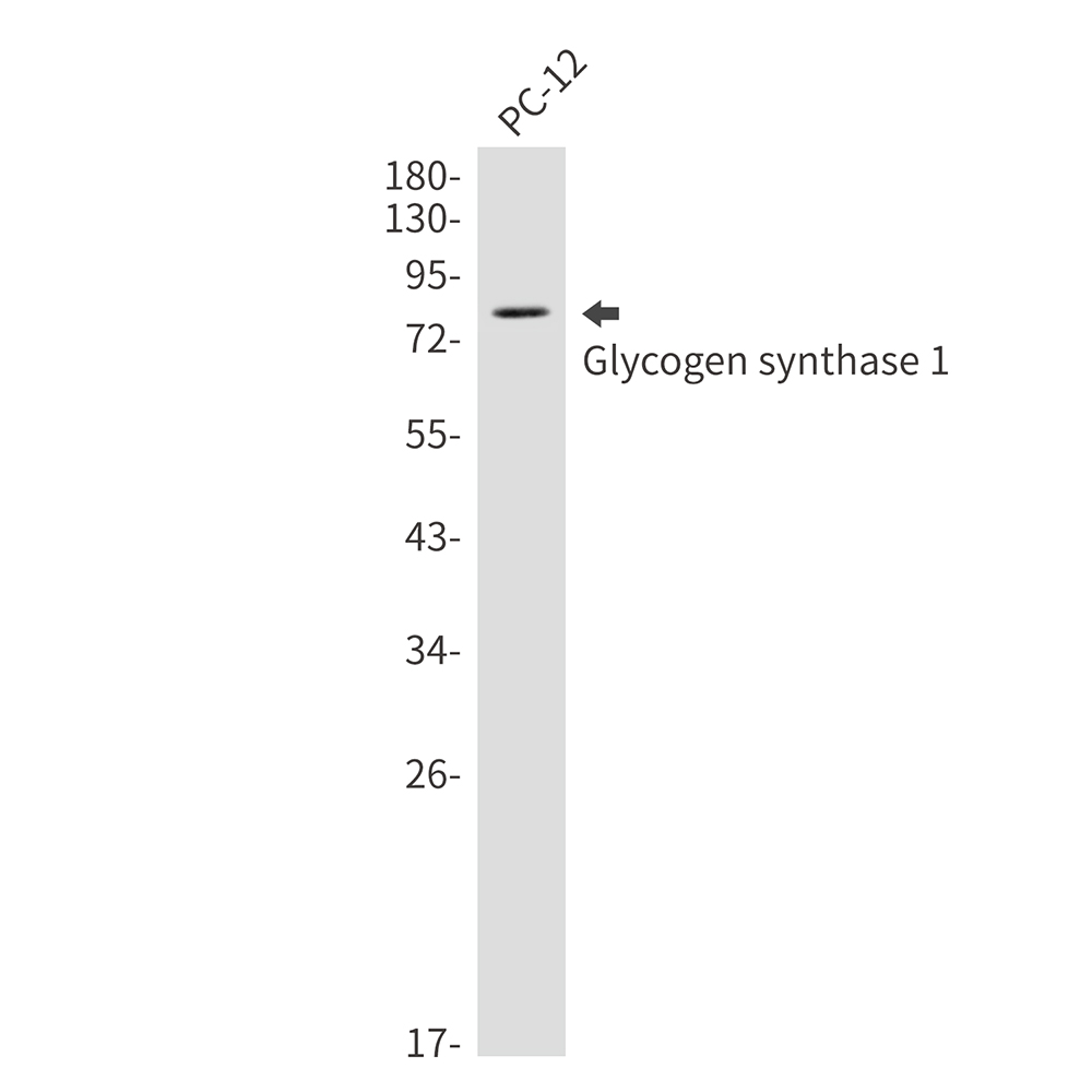 Glycogen Synthase 1 Rabbit mAb