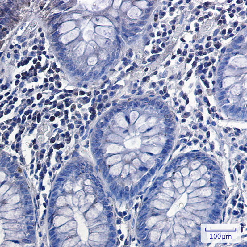 Phospho-Glycogen synthase (Ser641) Rabbit mAb