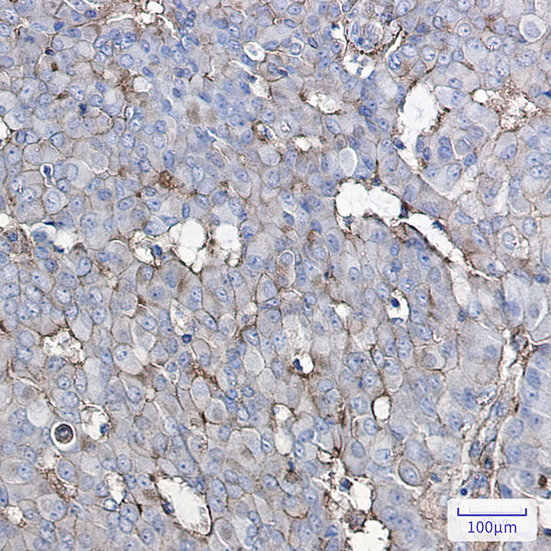 GNAQ Rabbit mAb