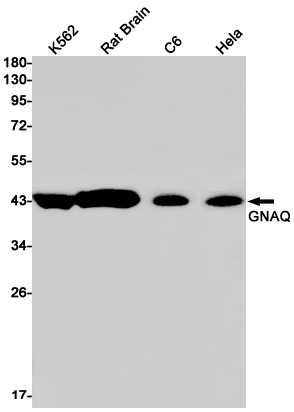 GNAQ Rabbit mAb