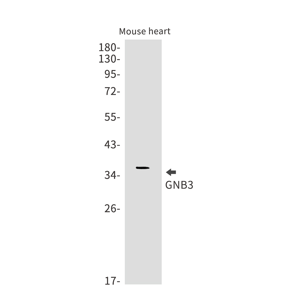 GNB3 Rabbit mAb