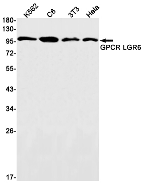 LGR6 Rabbit mAb