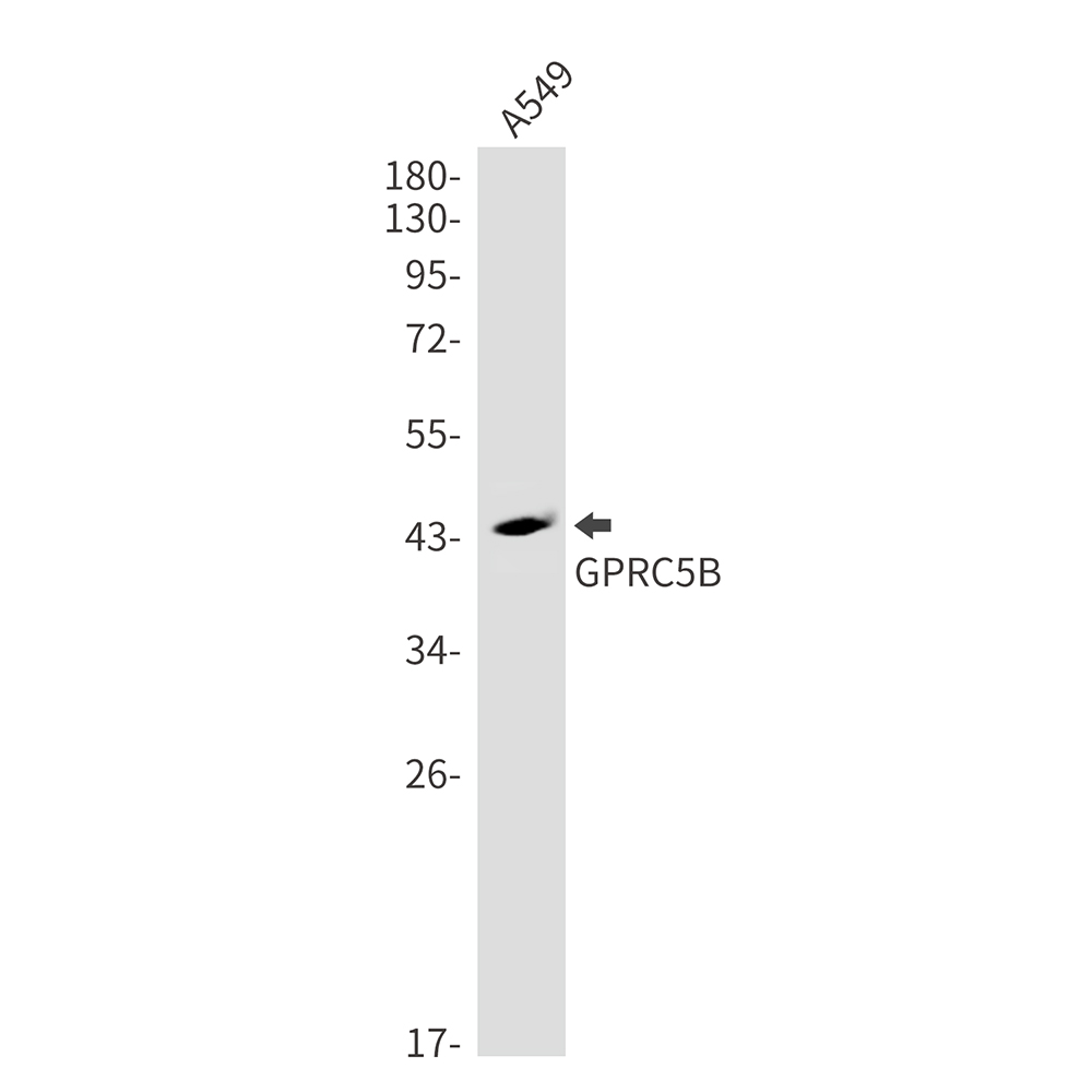 GPRC5B Rabbit mAb