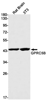 GPRC5B Rabbit mAb