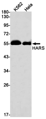 HARS Rabbit mAb