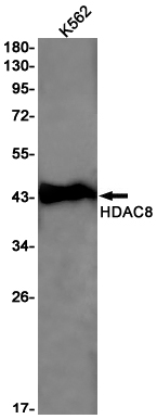 HDAC8 Rabbit mAb