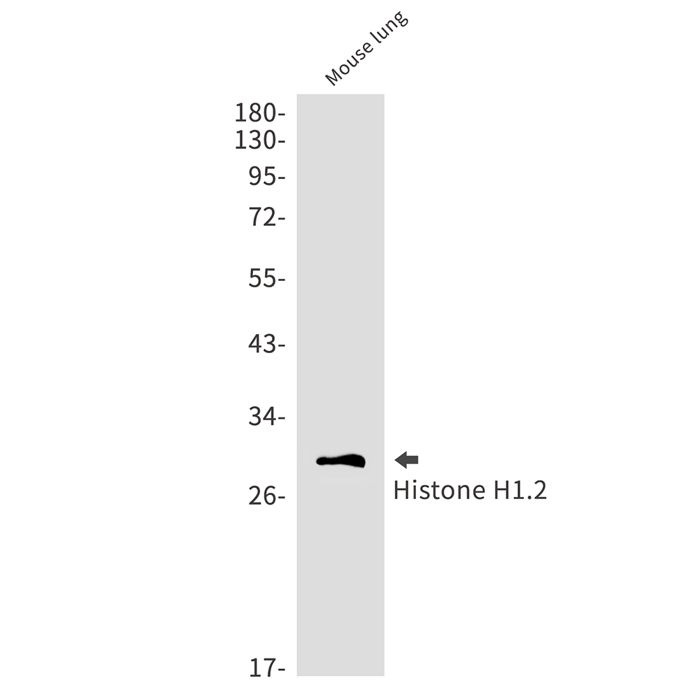 Histone H1.2 Rabbit mAb