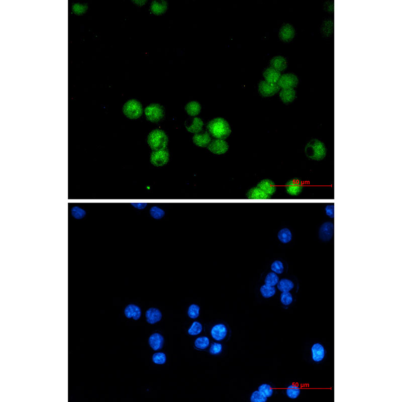 hnRNP K Rabbit mAb