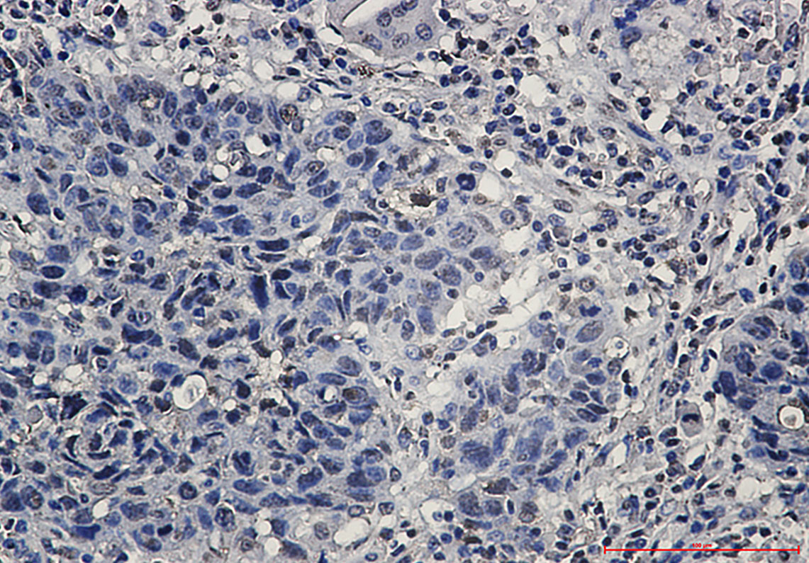 hnRNP K Rabbit mAb