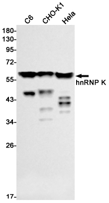 hnRNP K Rabbit mAb