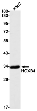 HOXB4 Rabbit mAb