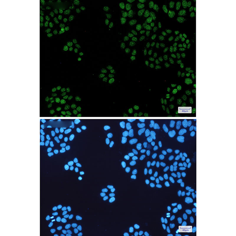 HP1 alpha Rabbit mAb