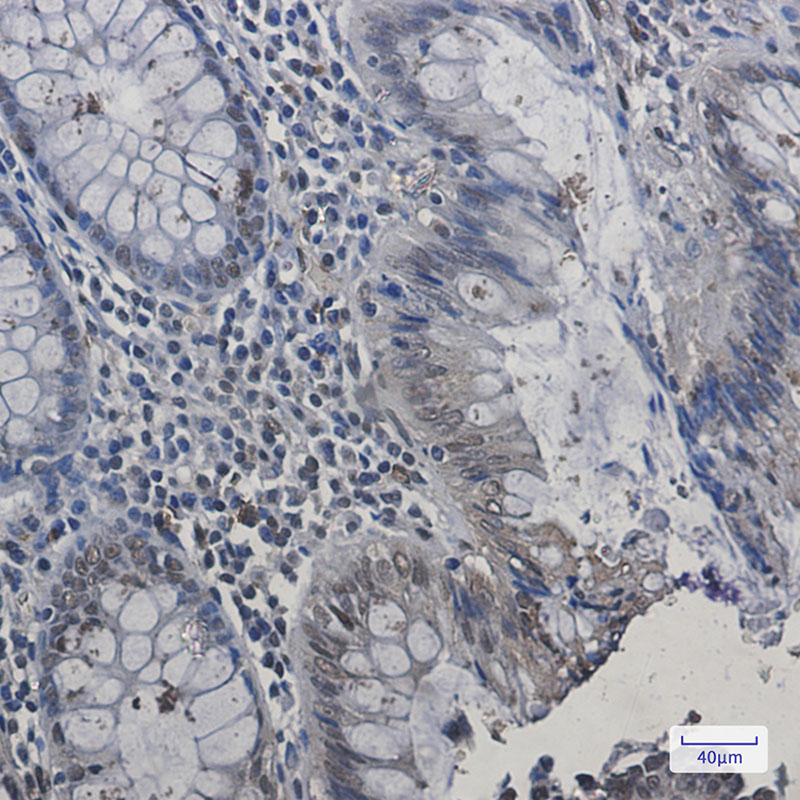 HP1 alpha Rabbit mAb
