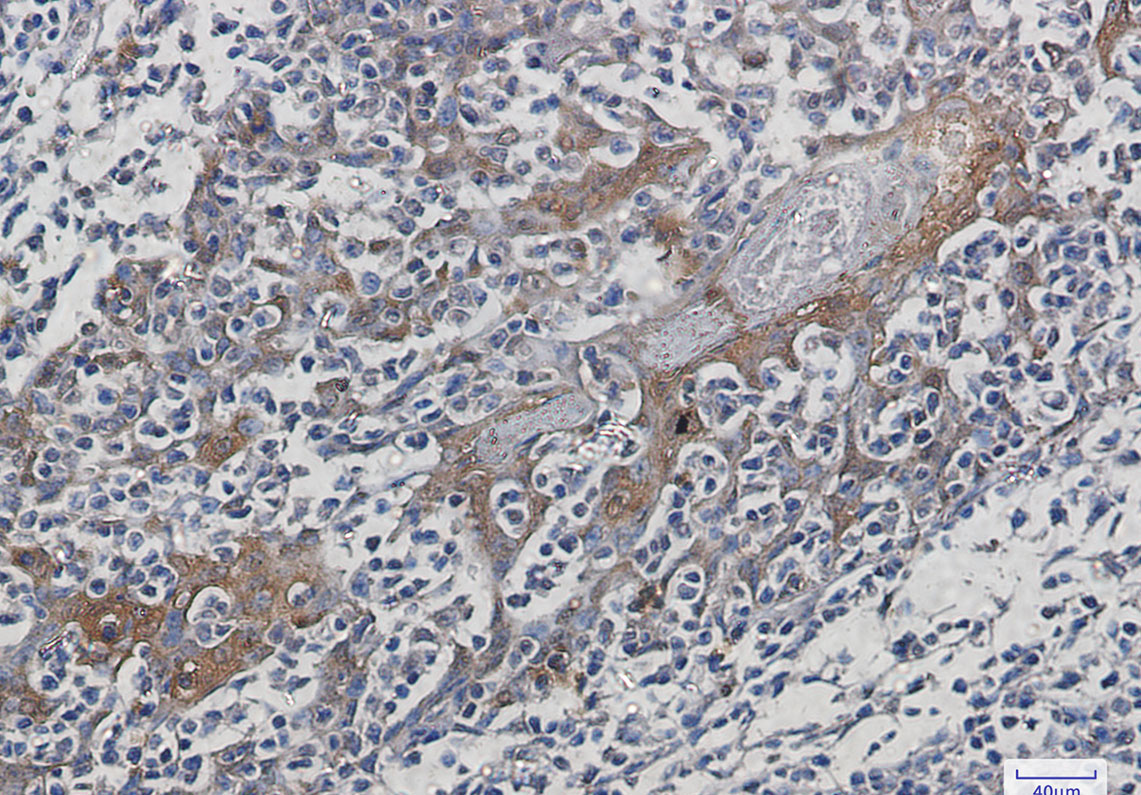 Hsp70 Rabbit mAb