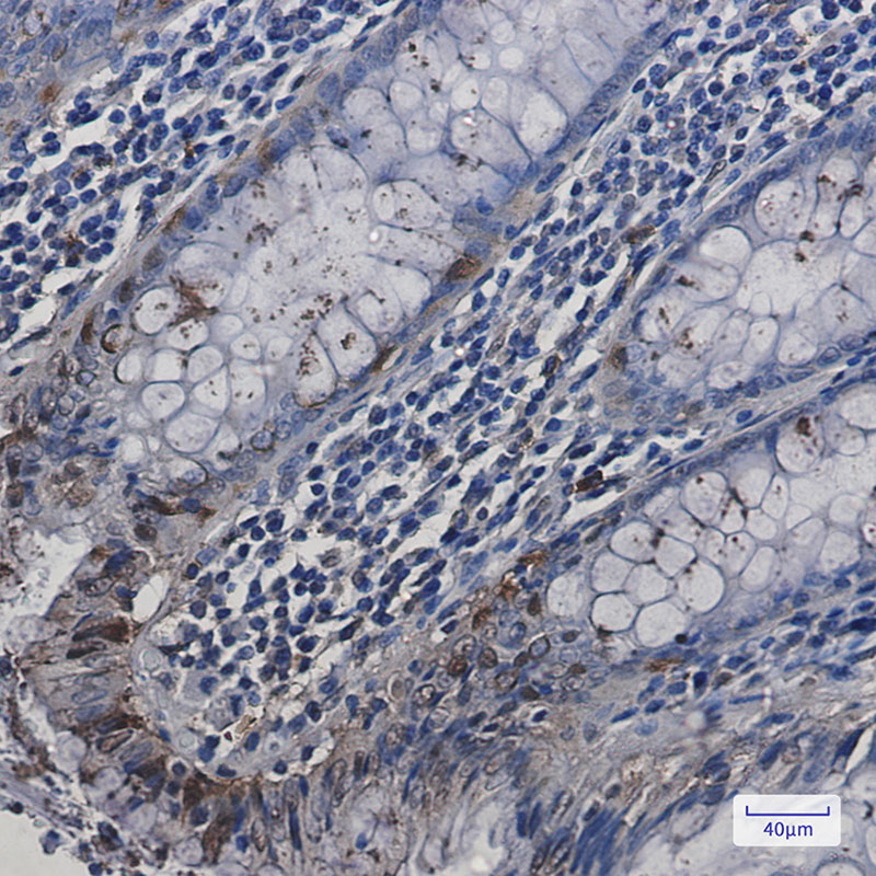 HspA2 Rabbit mAb