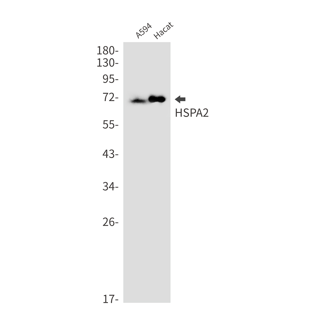 HspA2 Rabbit mAb