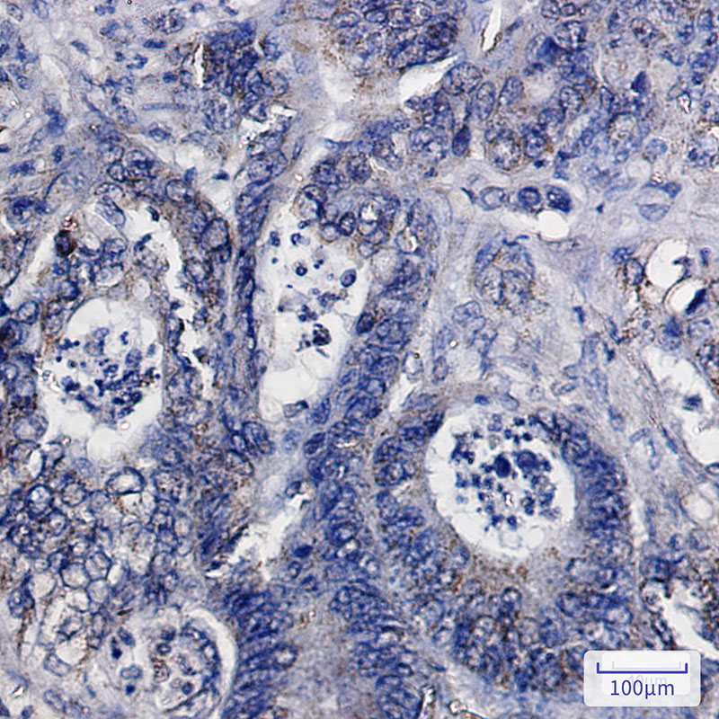 IDH2 Rabbit mAb