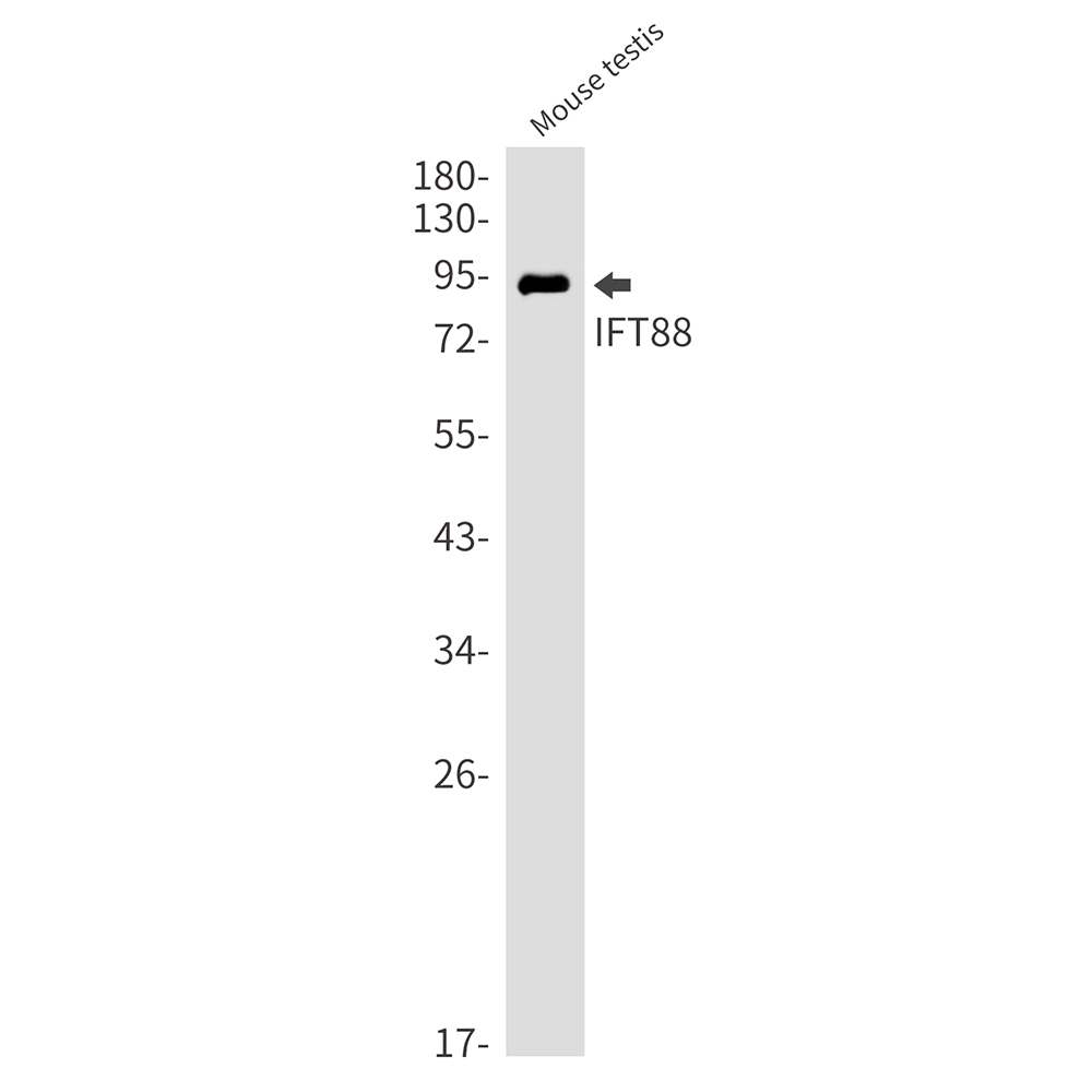 IFT88 Rabbit mAb