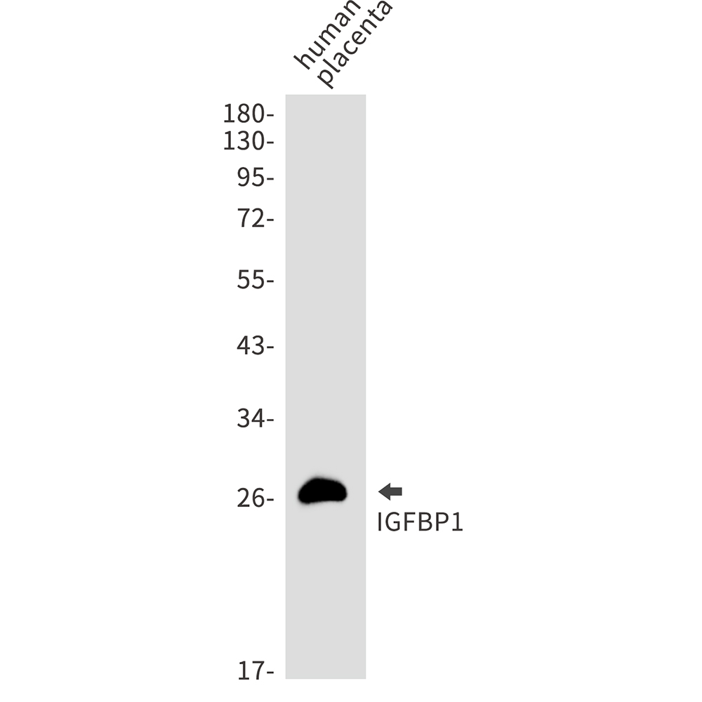 IGFBP1 Rabbit mAb