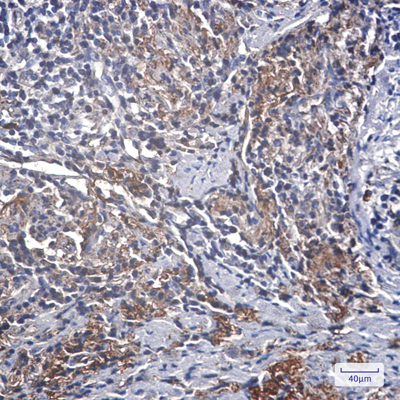 IGFBP7 Rabbit mAb