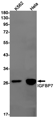 IGFBP7 Rabbit mAb