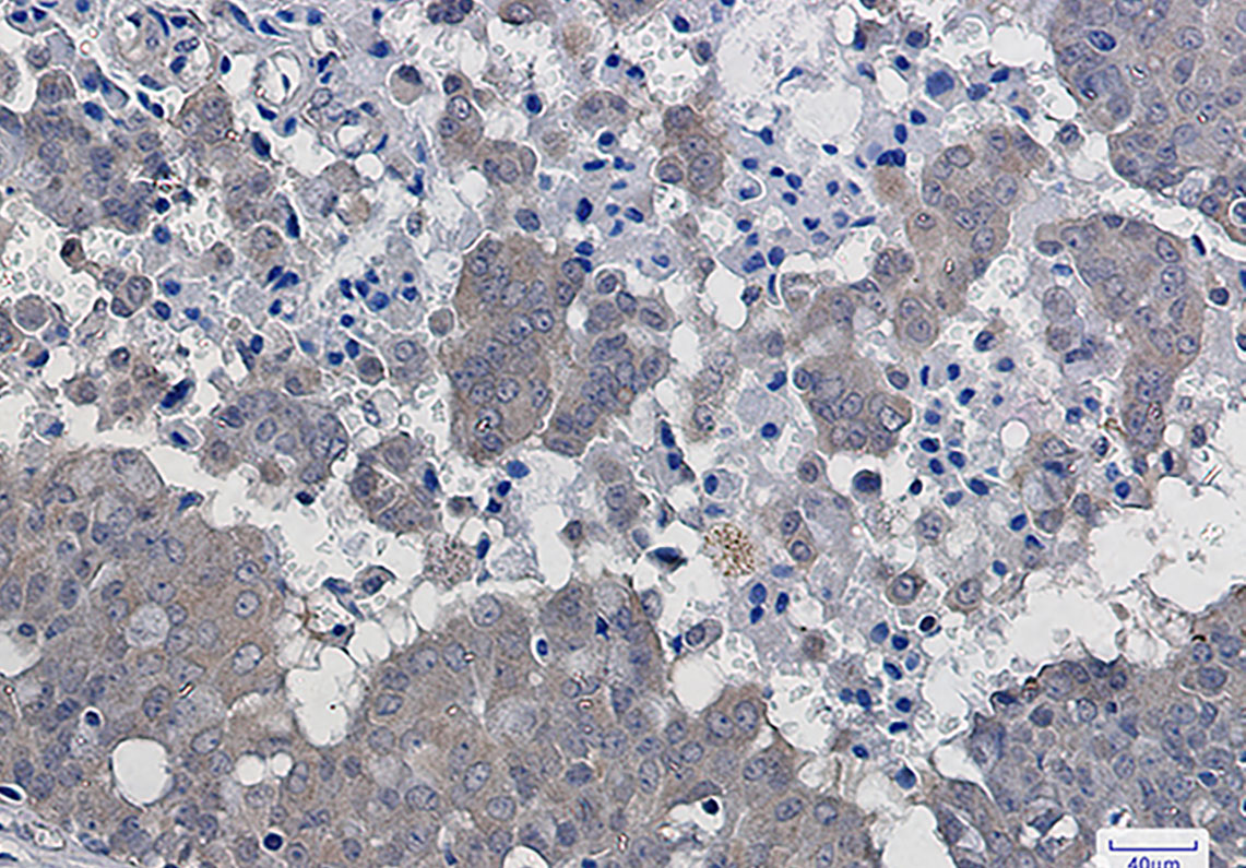 IKB beta Rabbit mAb