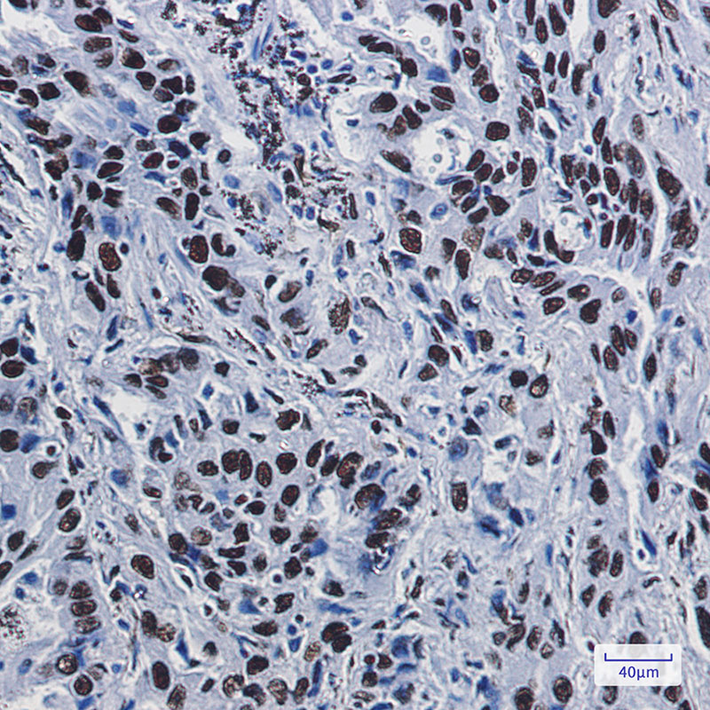 ILF3 Rabbit mAb