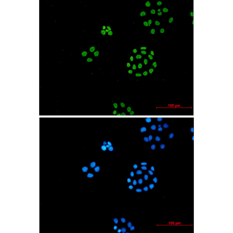ILF3 Rabbit mAb
