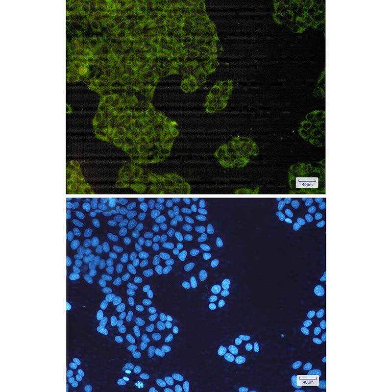 IMP3 Rabbit mAb