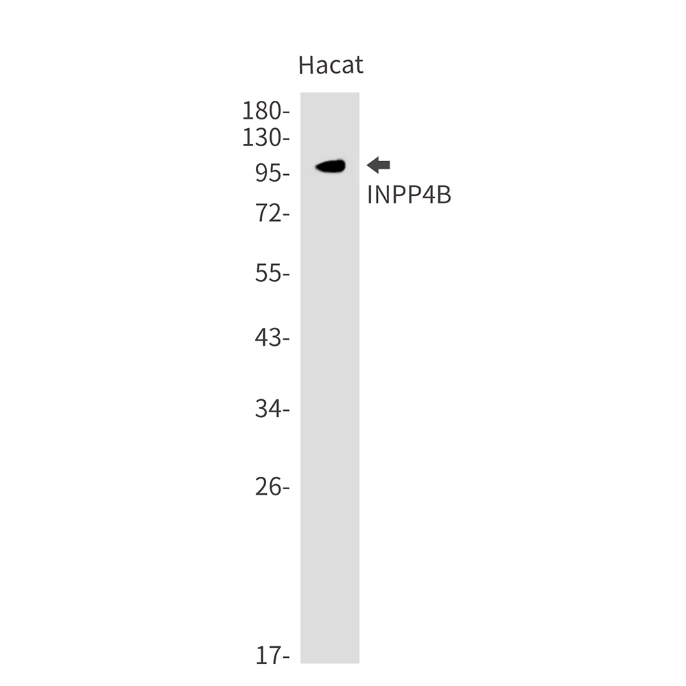 INPP4B Rabbit mAb