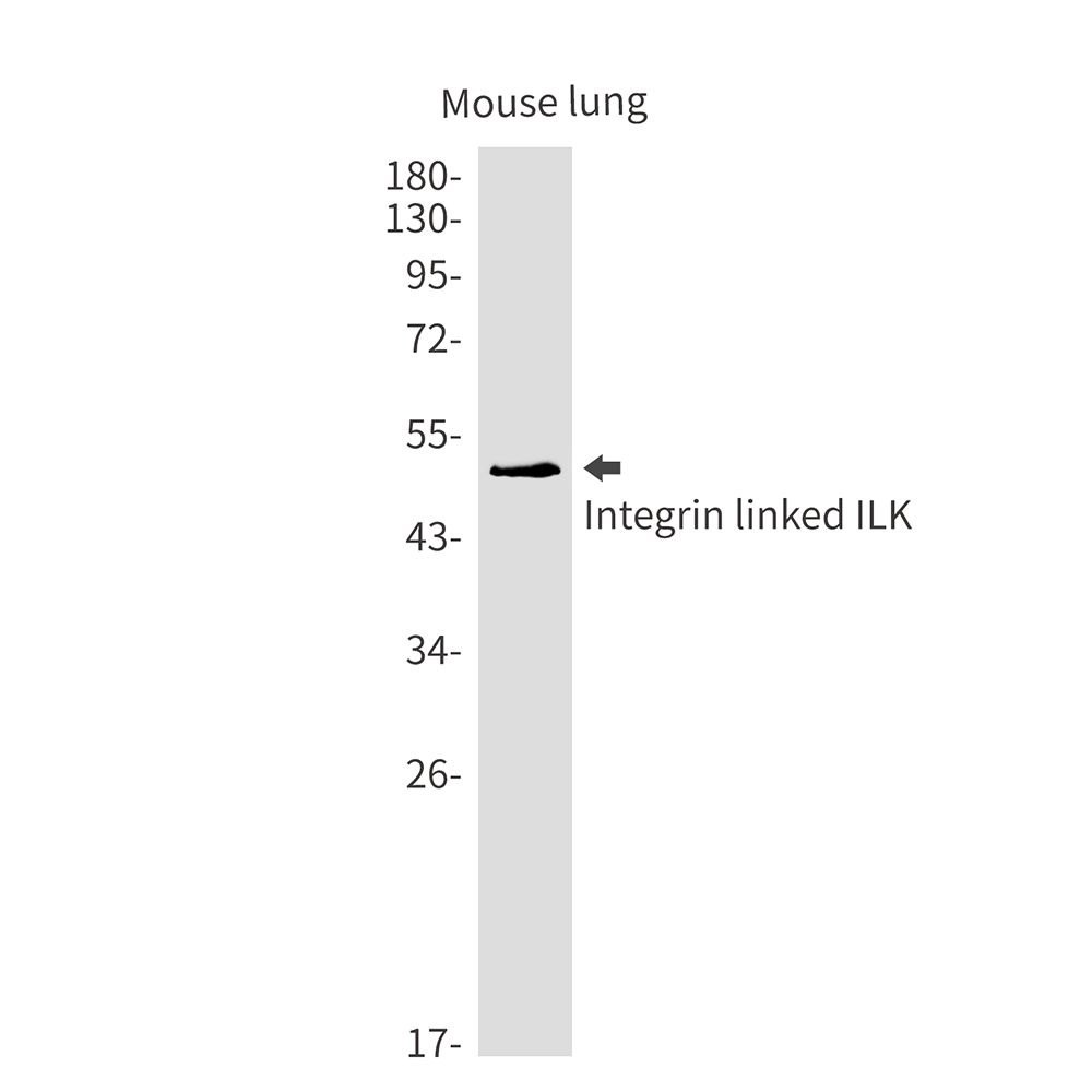 Integrin Linked ILK Rabbit mAb