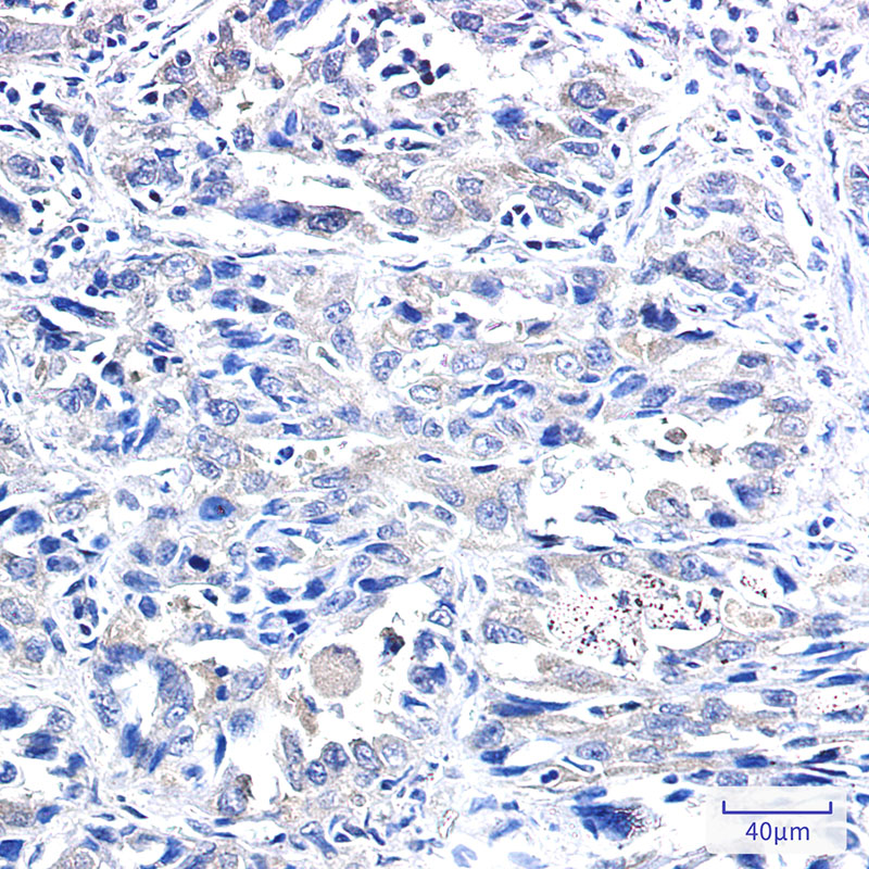 IRF1 Rabbit mAb