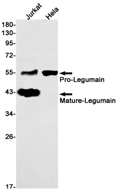 Legumain Rabbit mAb