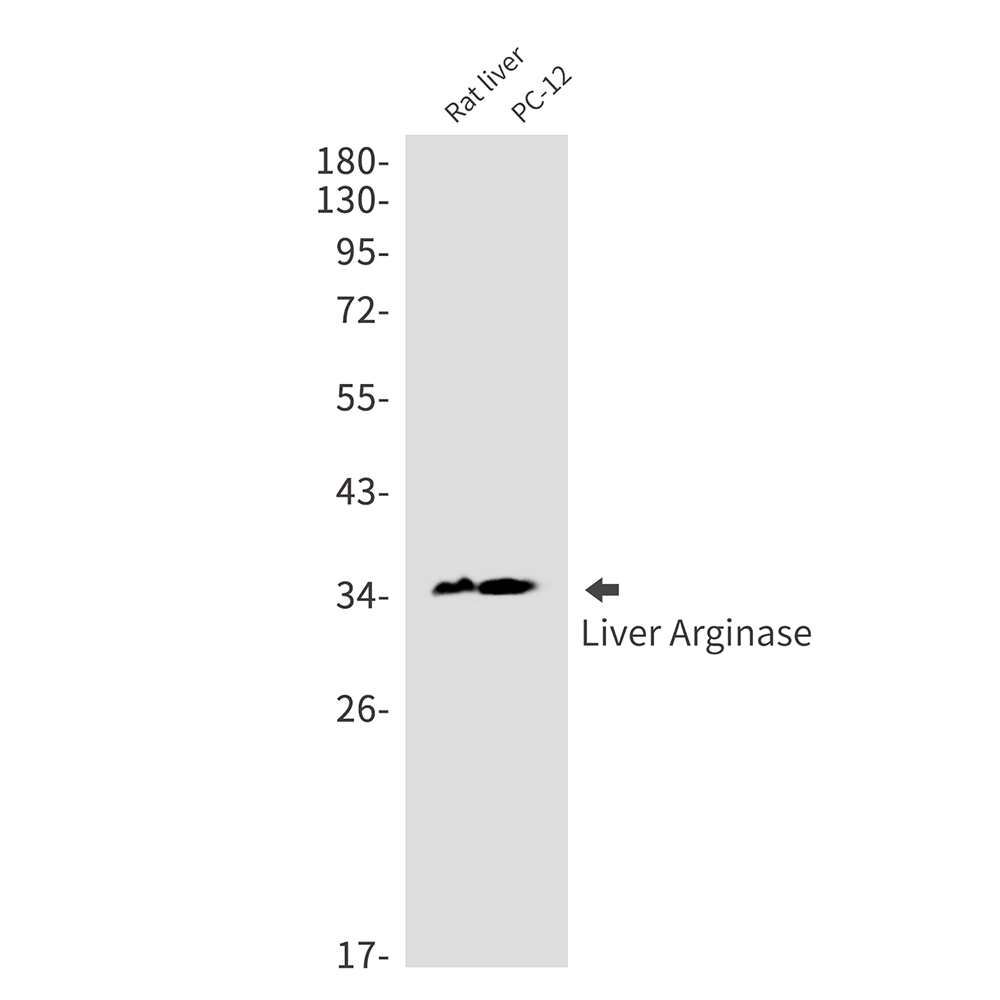Liver Arginase Rabbit mAb