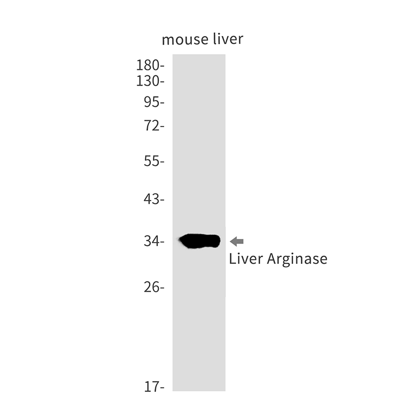 Liver Arginase Rabbit mAb