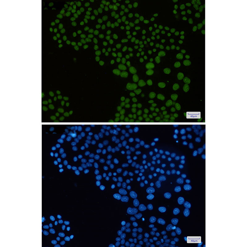 Macro H2A.1 Rabbit mAb