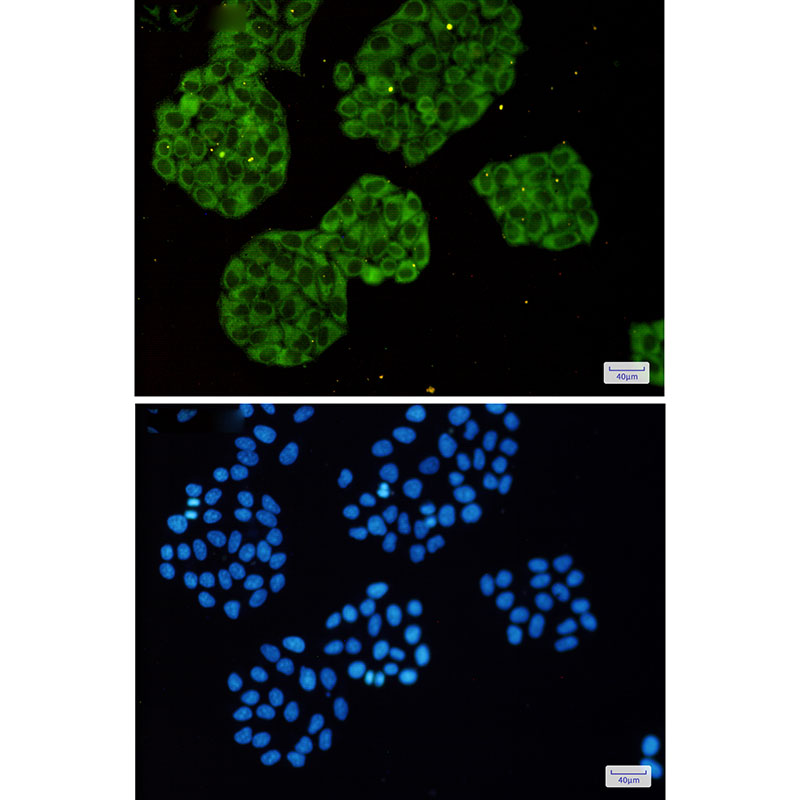 MetRS Rabbit mAb