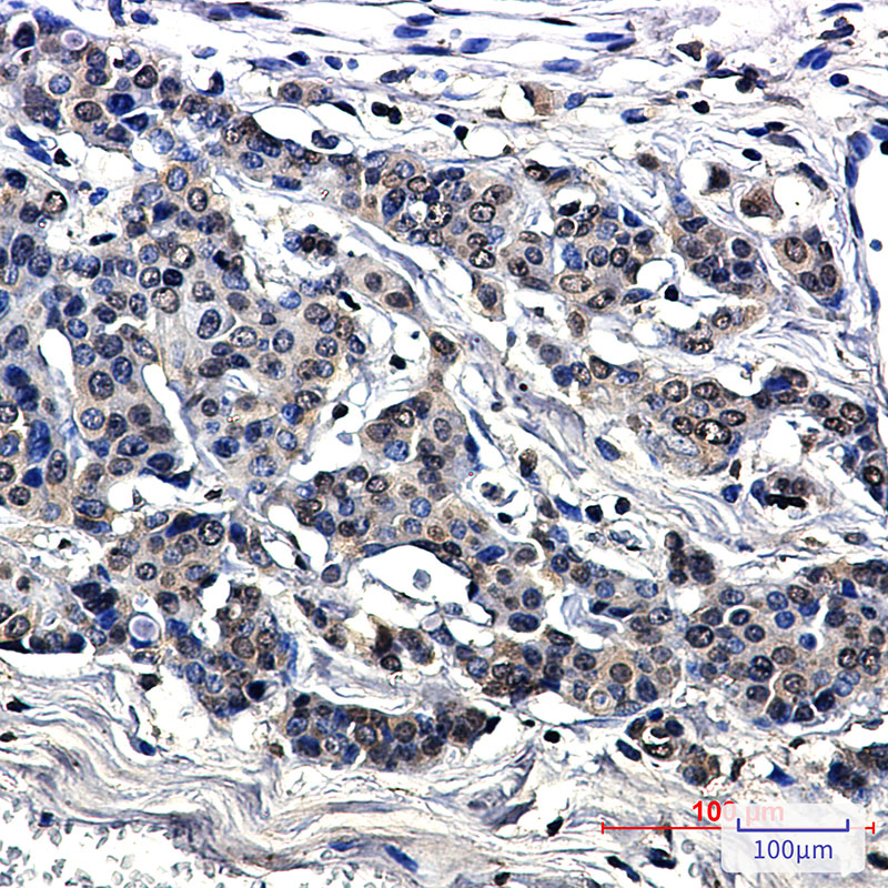 MetRS Rabbit mAb